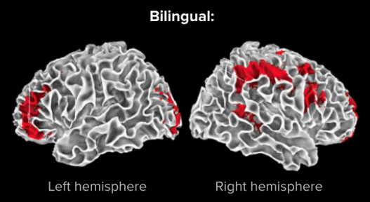 bilingual brain