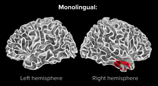 monolingual brain